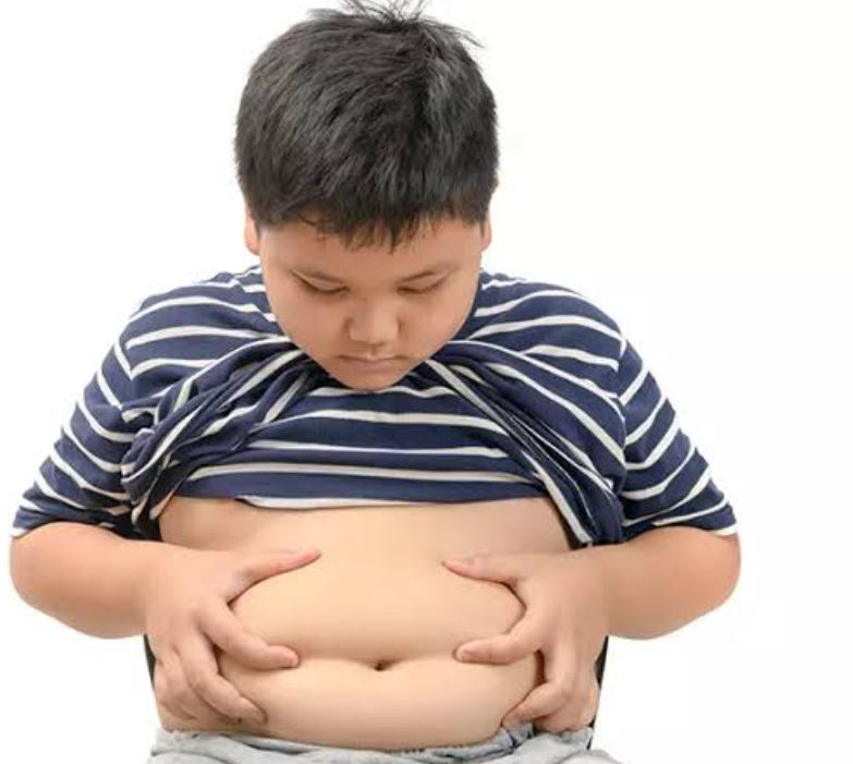 Obesitas pada Anak, Bunda Wajib Waspada! Ini Ciri-ciri Anak Obesitas
